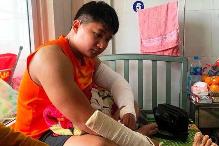 Shipper Lâm Anh Đạt bị đánh gãy 2 tay tại bệnh viện